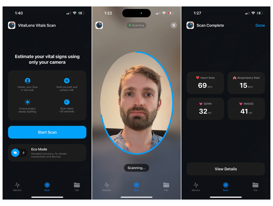 vitallens-ios Public Release